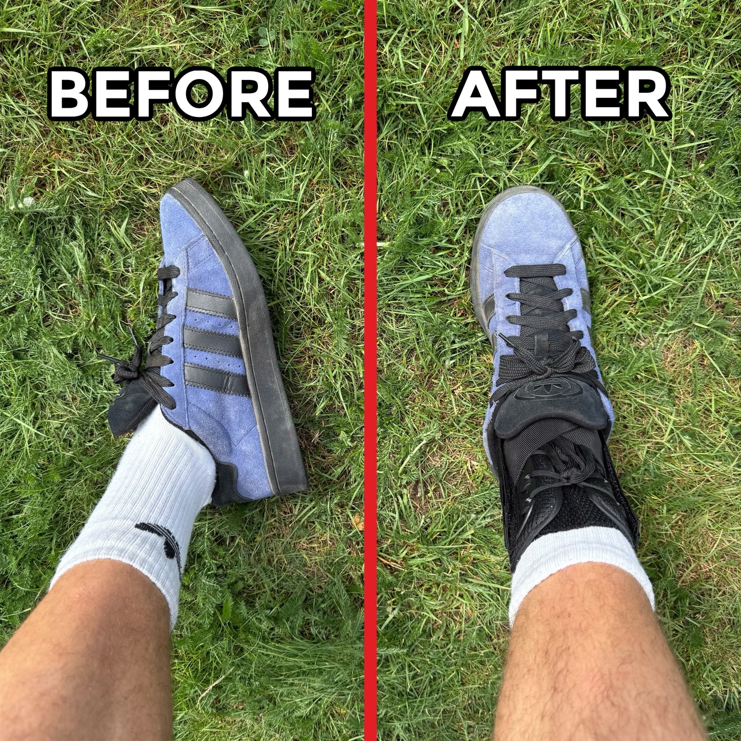 Ankle Brace